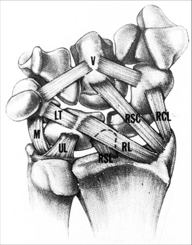 https://upload.orthobullets.com/topic/6005/images/TTC Illustration - volar wrist ligaments_moved.jpg